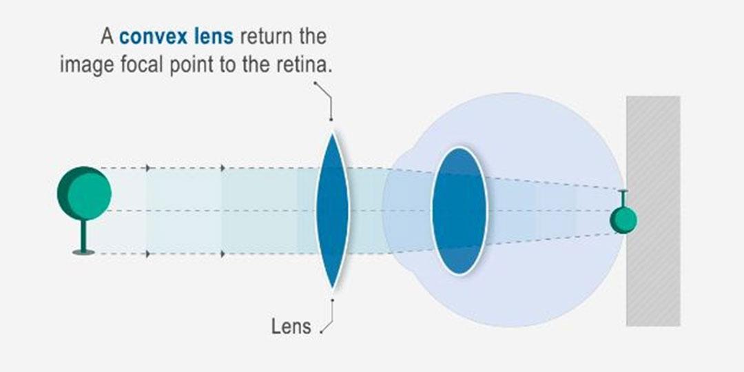 kő a látás kezelésére mikor jobb ellenőrizni a látását