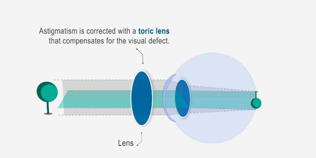 Nightingale Optika - Látásproblémák és tüneteik